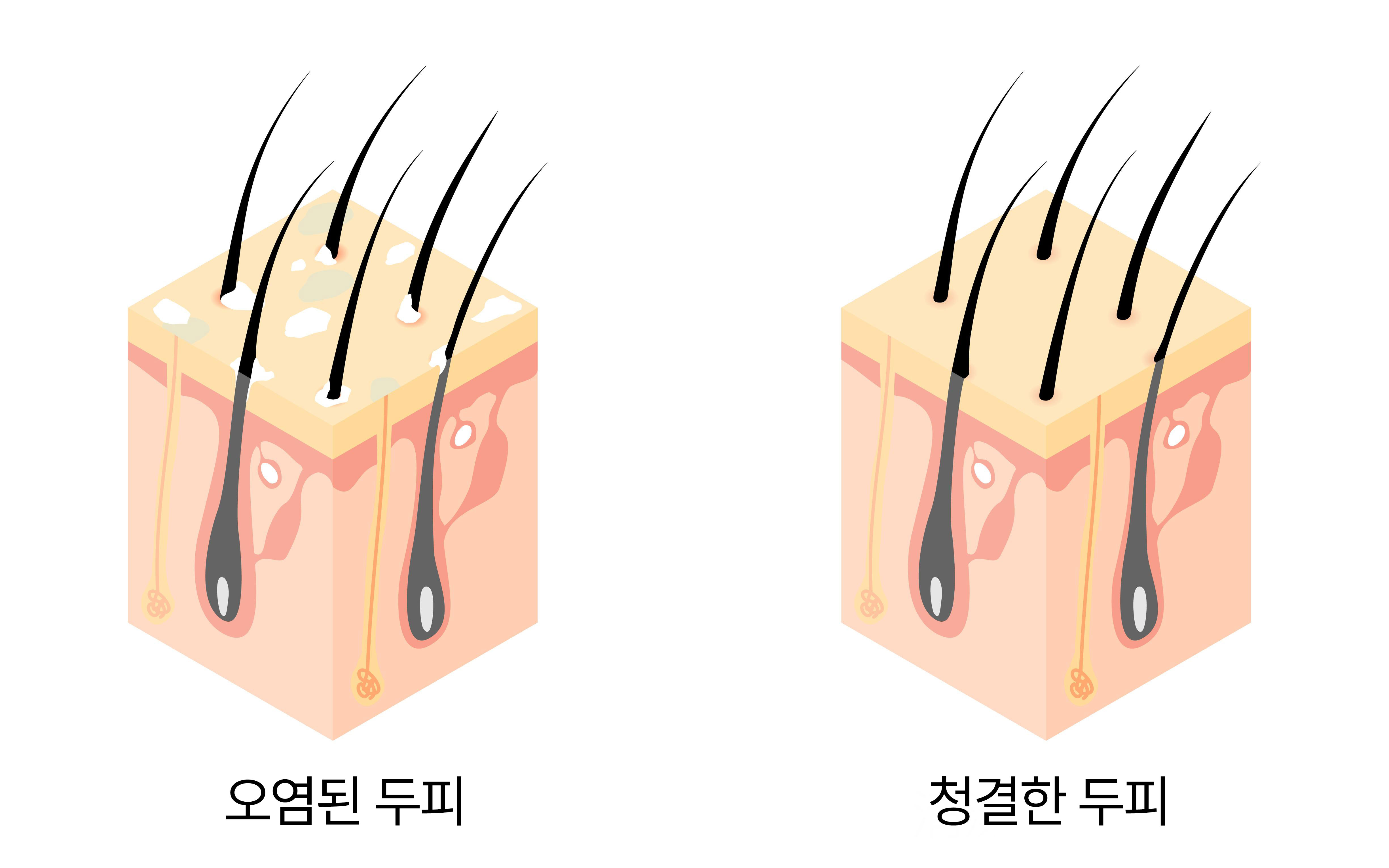 두피 단면